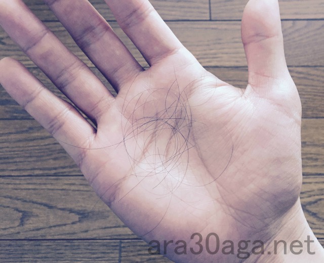 抜け毛からAGAを判断するための3つの特徴とセルフチェック方法